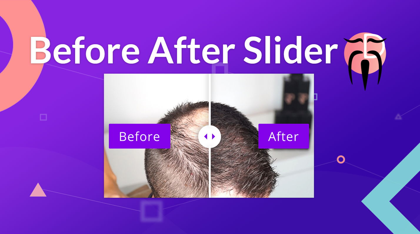 Divi Sensei Before After Slider v2.2.2（已汉化） - Wp Divi前后对比图插件